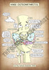 Knee Joint Osteoarthritis A4 Printable Poster