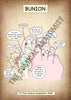 A4 Bunion Printable Poster