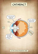 A4 Cataract Printable Poster