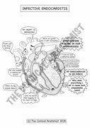 Infective Endocarditis Coloring Page