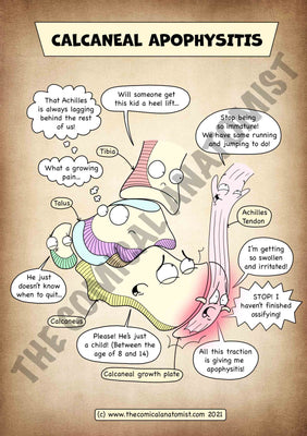 A4 Calcaneal Apophysitis (Sever's Disease) Printable Poster
