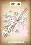 A4 Bunion Printable Poster