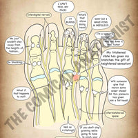 A4 Morton's Neuroma Printable Poster (Instant Download)